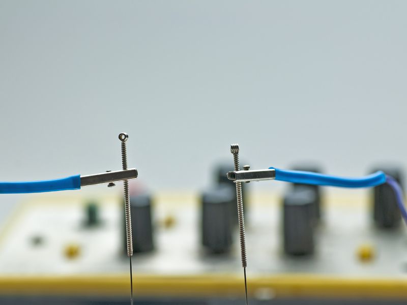 SinoQi TCM Zürich - Elektroakupunktur