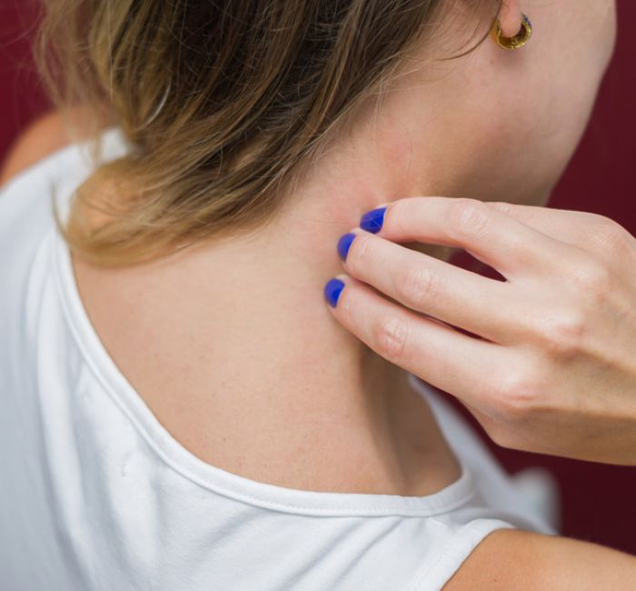 TCM bei Hauterkrankungen und Allergien