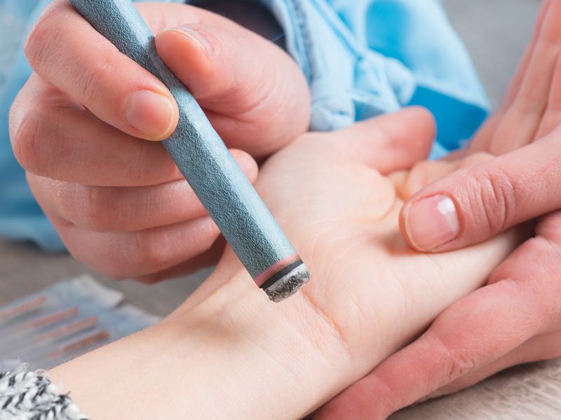 SinoQi TCM Zürich - Moxibustion