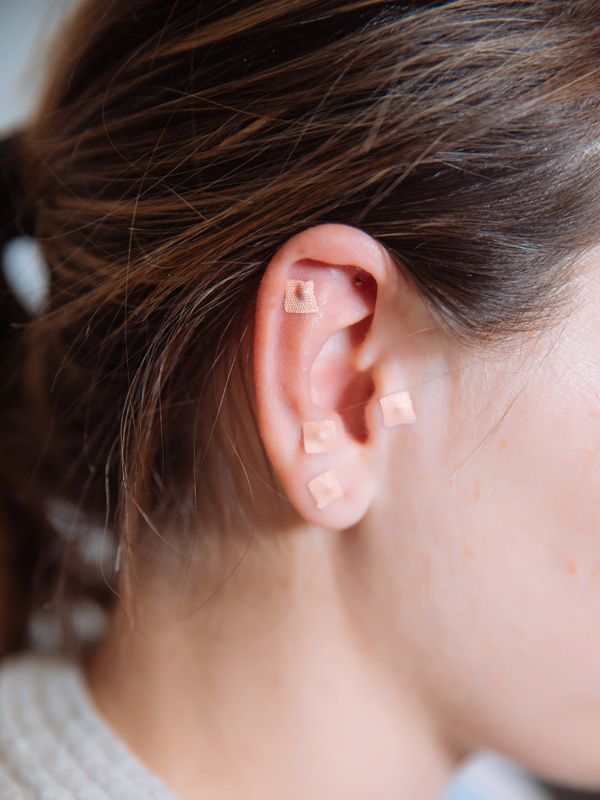 SinoQi TCM Zürich - Ohrakupunktur