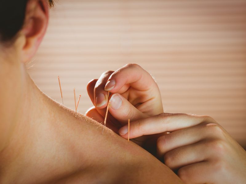 SinoQi TCM Zürich - Akupunktur