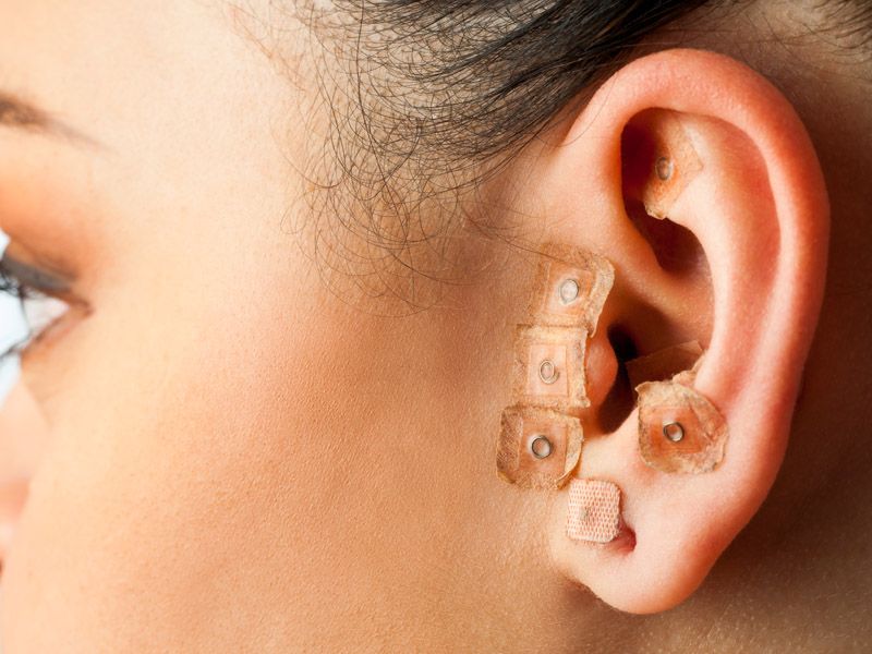 SinoQi TCM Zürich - Ohrakupunktur