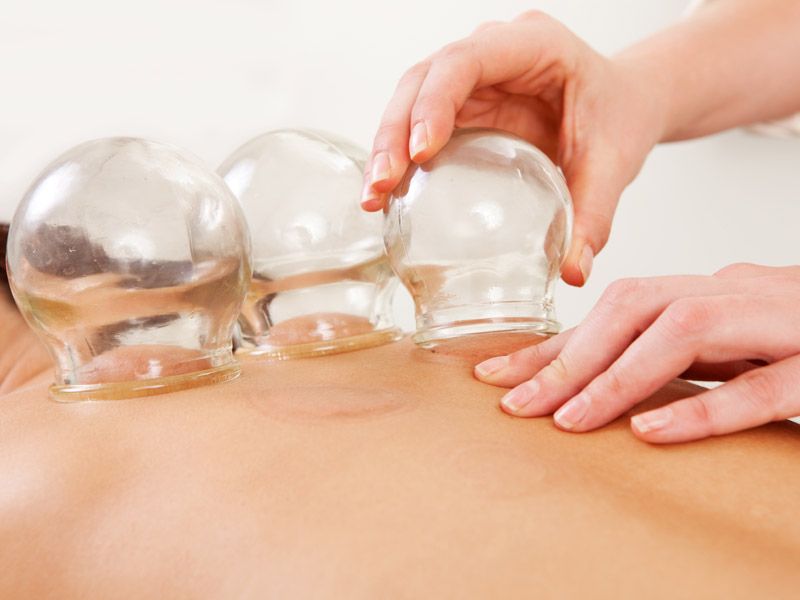 SinoQi TCM Zürich - Schröpfen